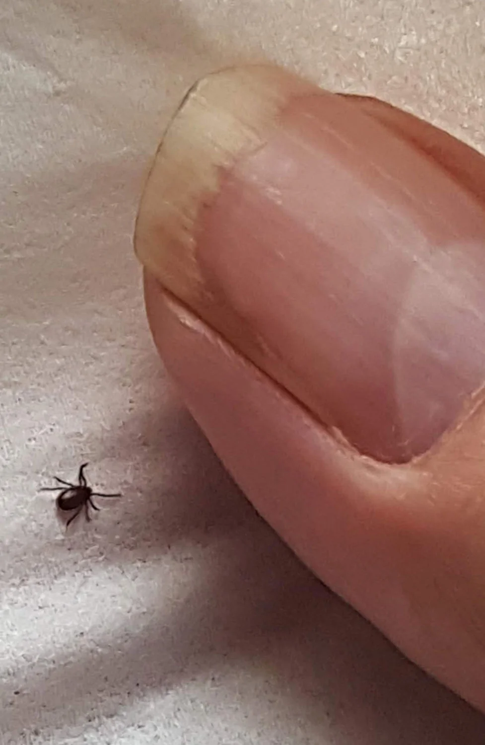 No, they’re not very obvious at this stage...a tick before it finds you is a wee spidery thing. (Note the eight legs - so it’s an arachnid.) As you can see from my unrealistically enlarged thumb, this shows a tick probably, oh, about 4-5 times actual size.