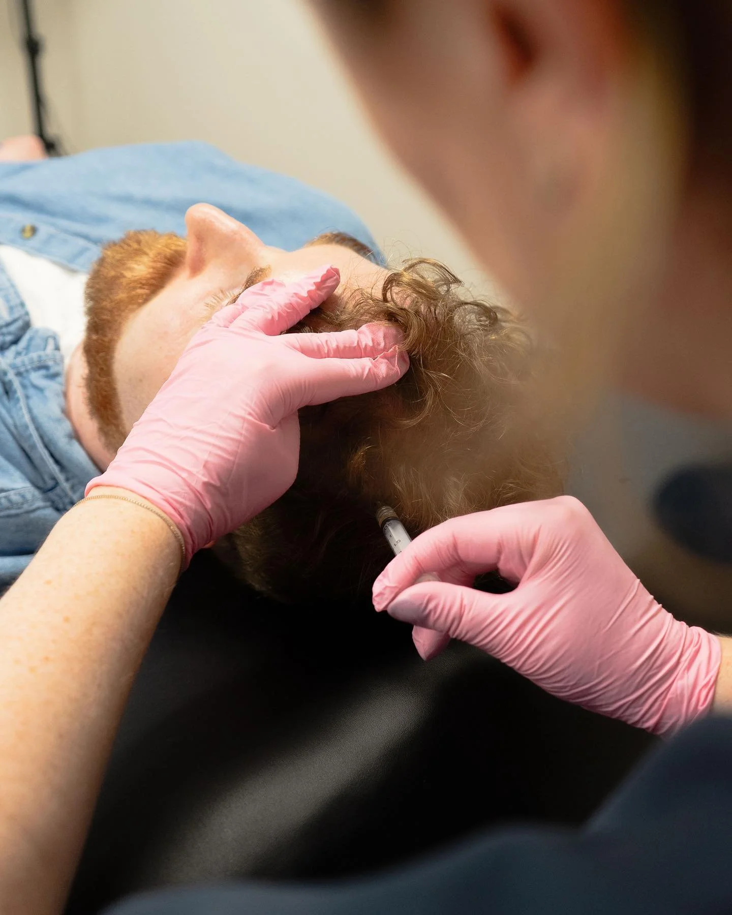 New hair growth loading ⏳ #PRP #HairGrowth