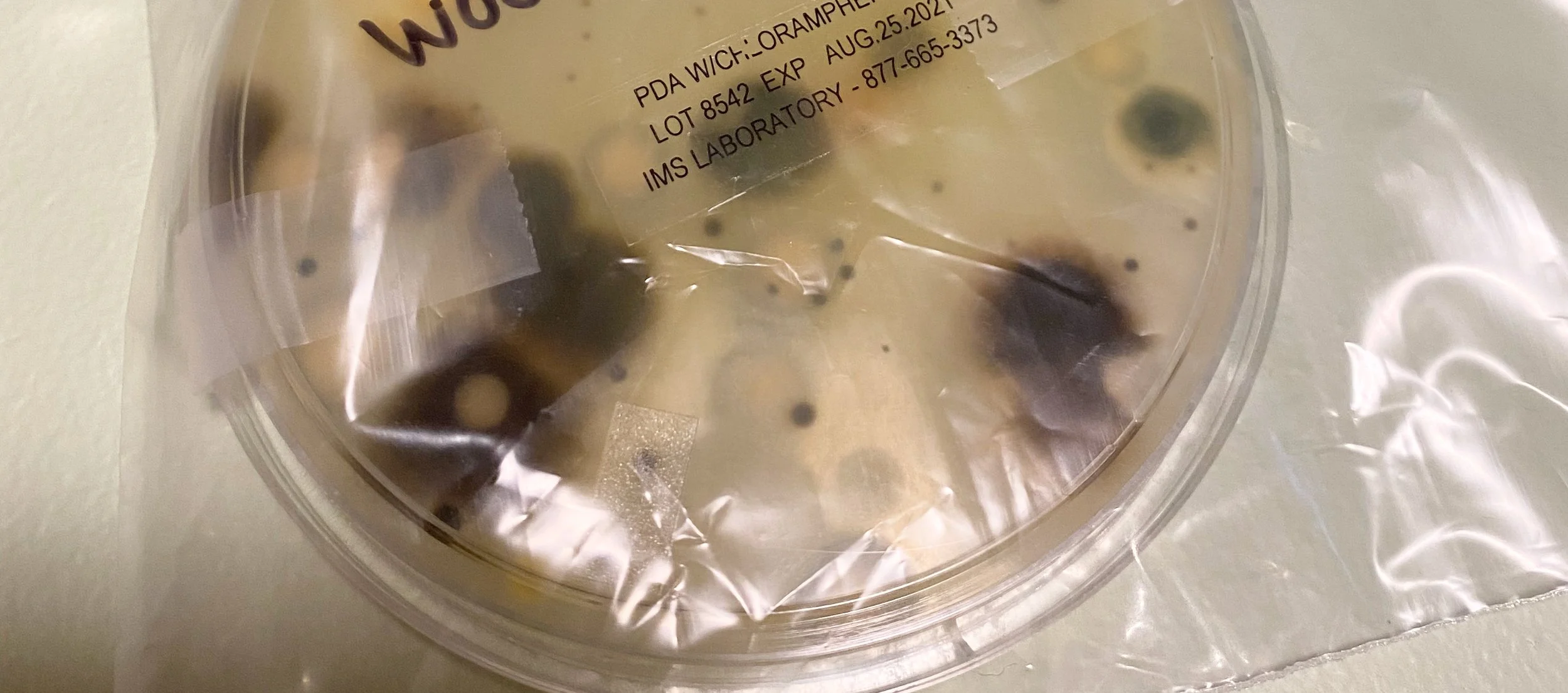 MOLD- Could it be the hidden root cause to your symptoms?