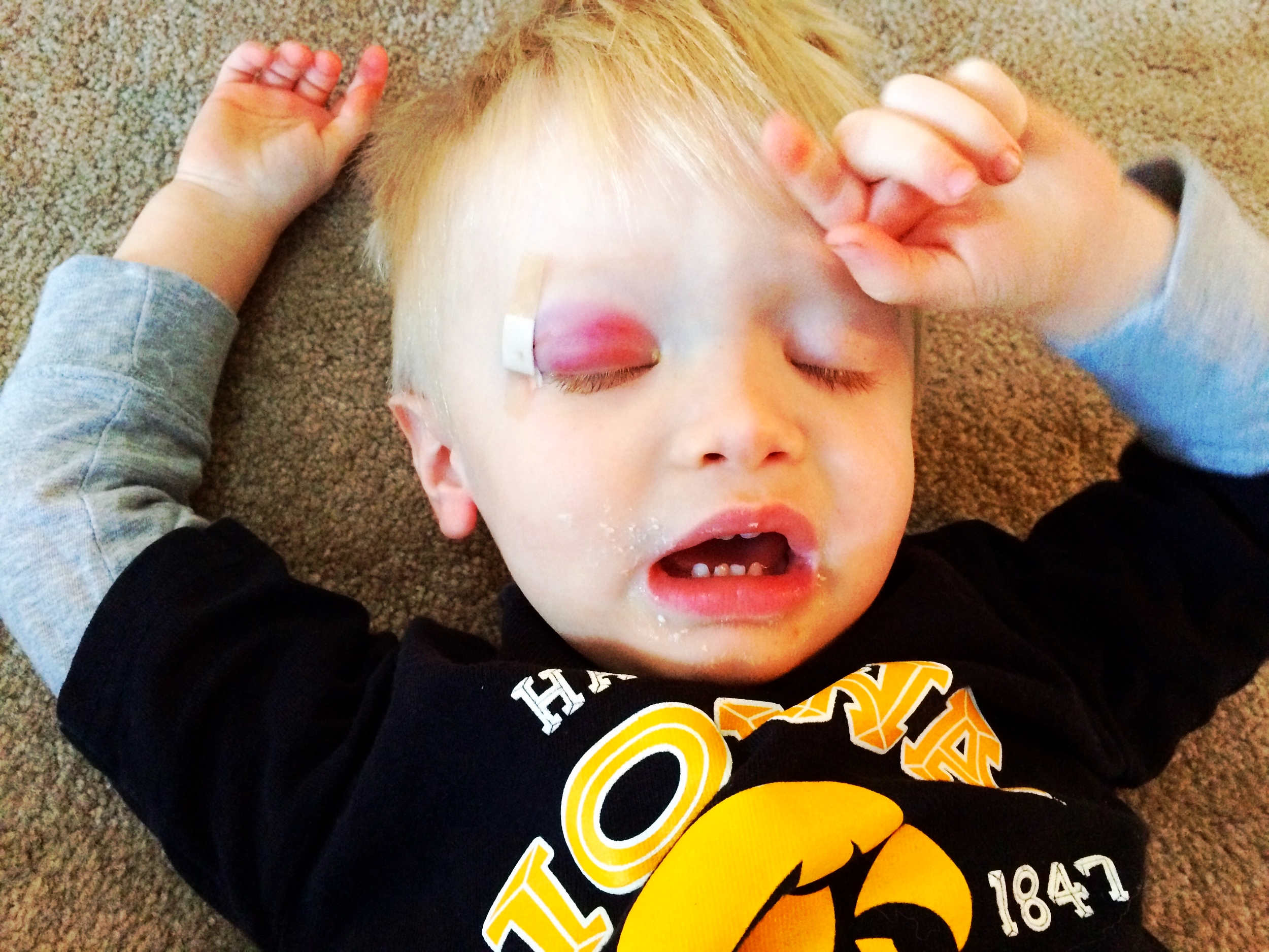 You should see the other guy...