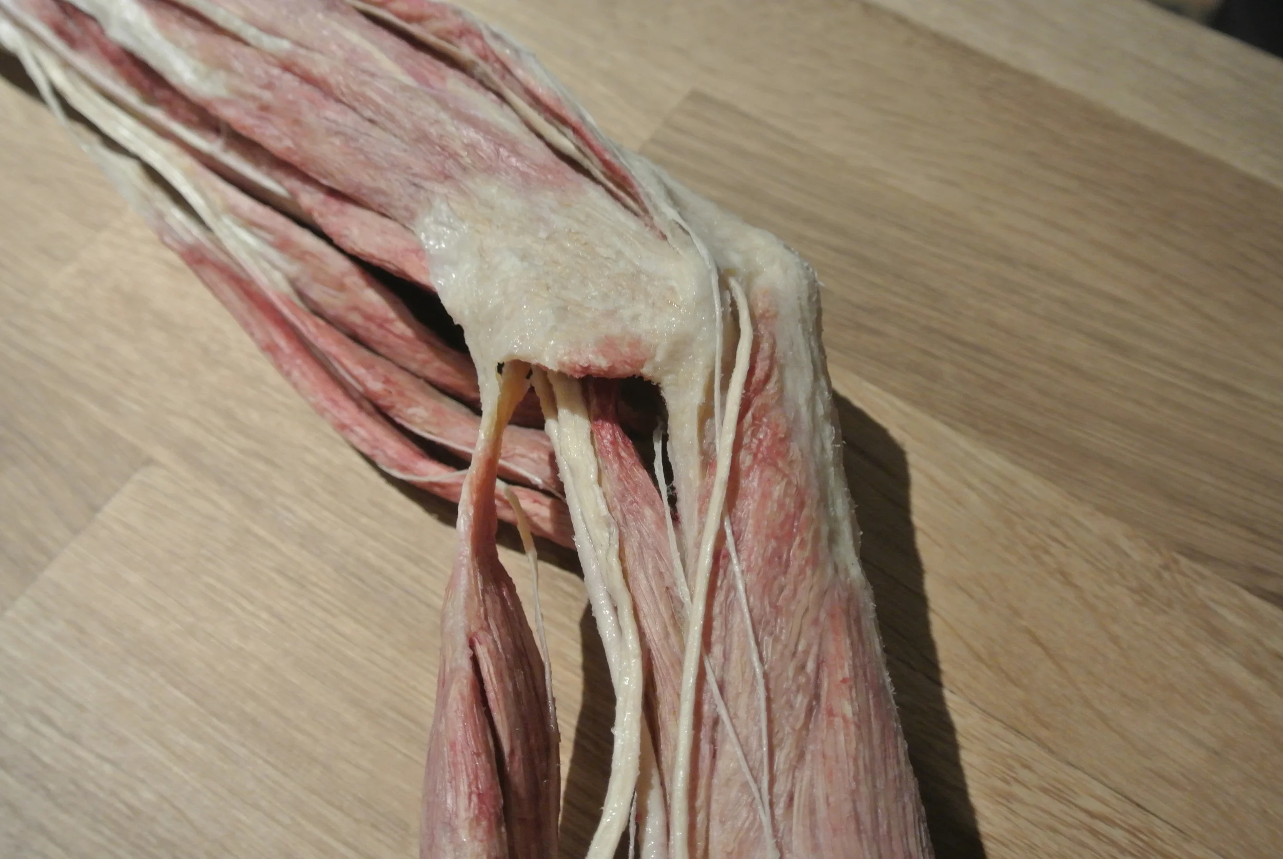 What Causes Pins and Needles?