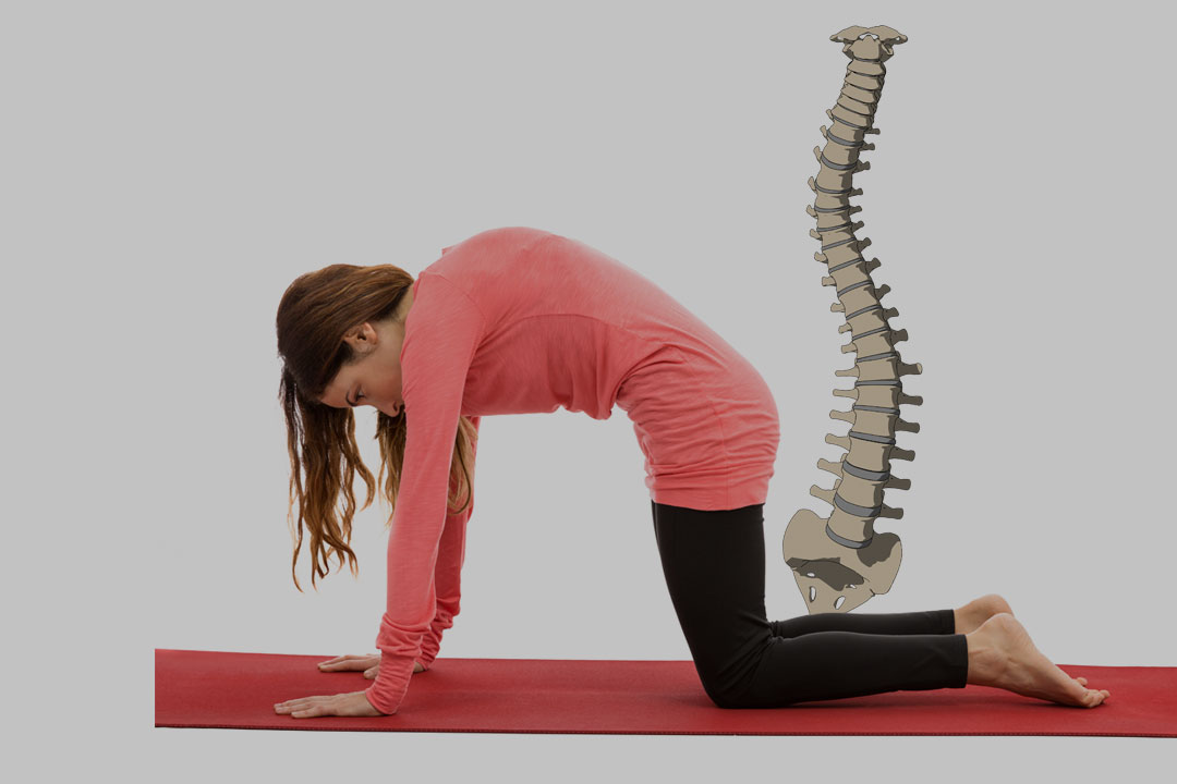 Teen Yoga for Scoliosis