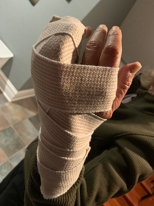 broken-bandaged-hand-2.jpg