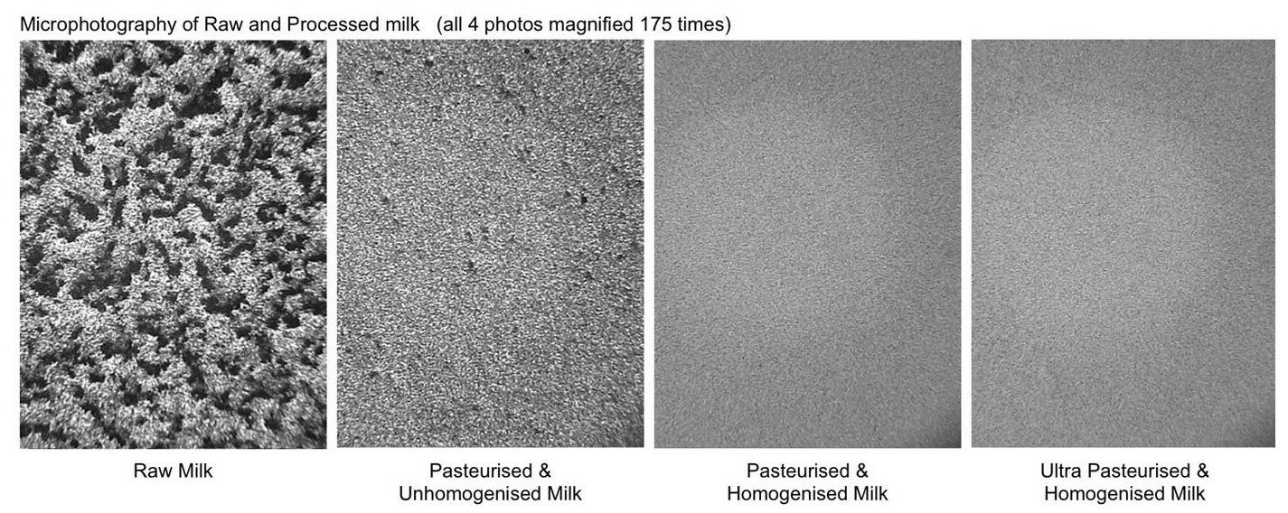 Microphotography of Raw & Processed Milk magnified 175 times