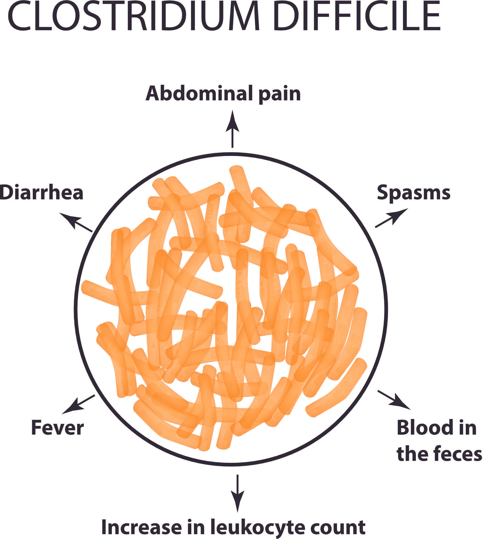 AdobeStock_144818257 clostridium.jpg