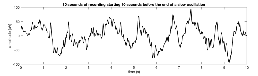 10s of slow-wave neural activity recorded by the Dreem EEG headband.