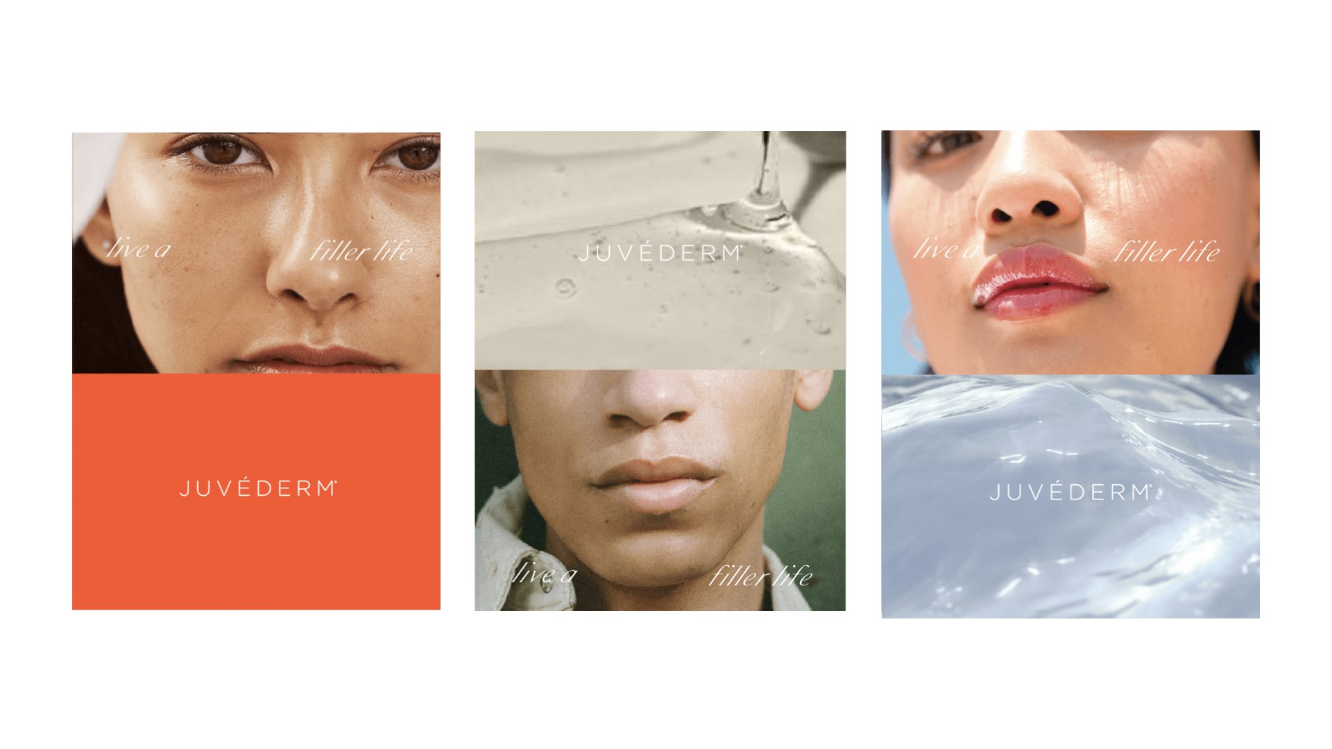 Juvéderm_FINAL.022.jpeg