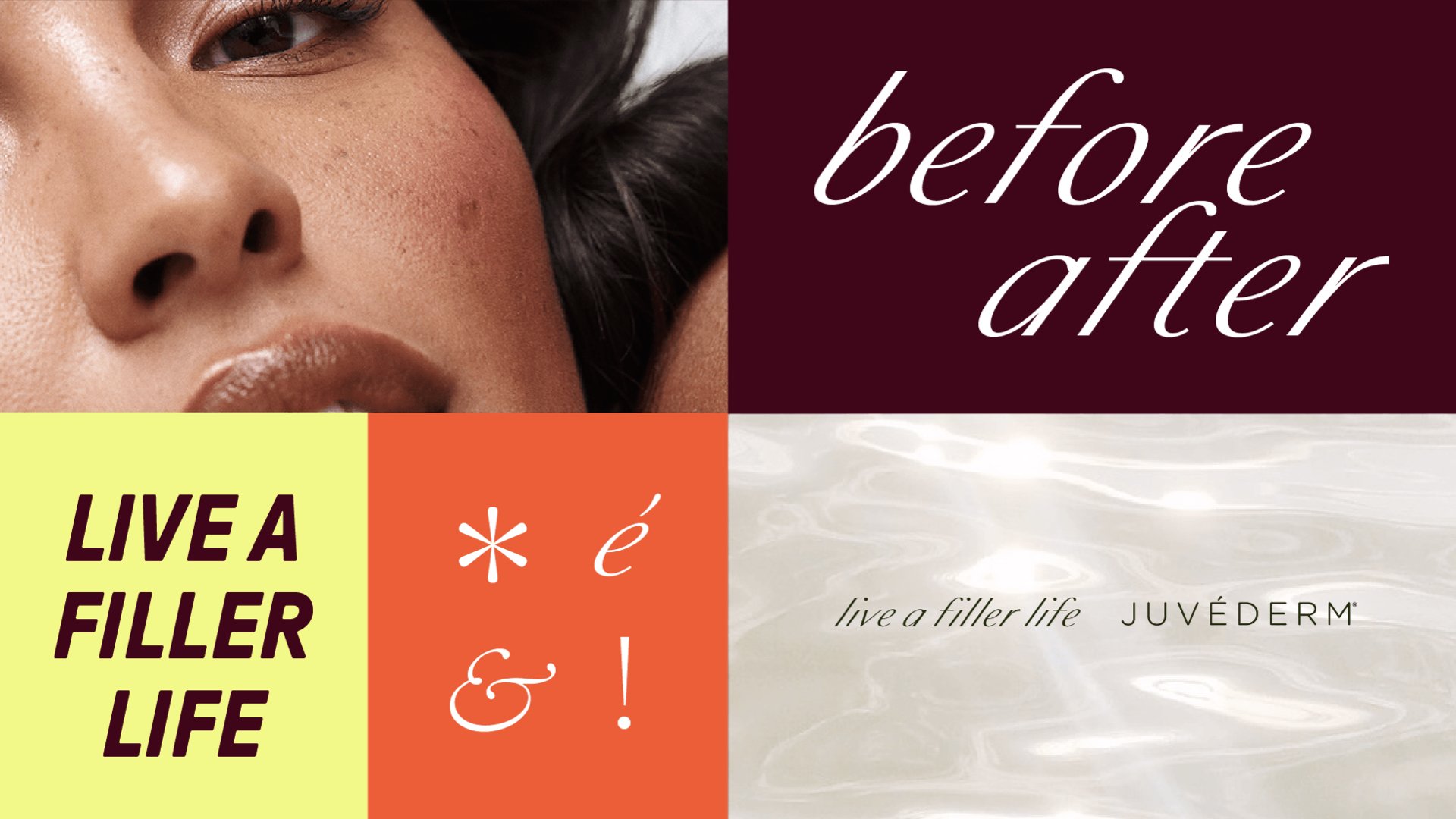 Juvéderm_FINAL.025.jpeg