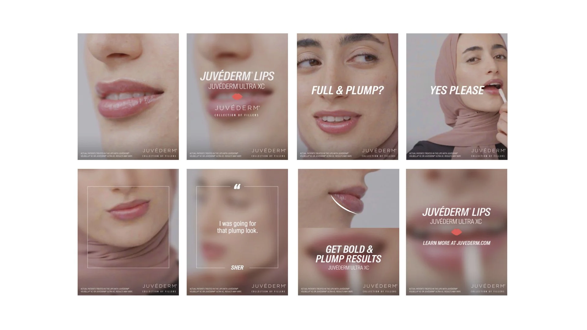 LIPS.001.jpeg