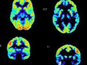 A Neuroscientist Uncovers A Dark Secret For nearly 20 years, neuroscientist Jim Fallon has studied the brains of psychopaths. After learning that his ancestry included alleged murderers, he decided to study his own brain. He was shocked at what he discovered. June 29, 2010 | National Public Radio Series, "Inside the Criminal Brain" Photo courtesy of Jim Fallon
