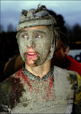 Greg LeMond in 1985, having what's known as a "Roubaix facial"