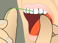  STEP 3 &nbsp;| &nbsp;Holding the floss tightly, gently saw the floss between your teeth. Then curve the floss into a C-shape against one tooth and gently slide it beneath your gums. 