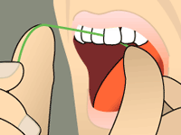 STEP 3 | Holding the floss tightly, gently saw the floss between your teeth. Then curve the floss into a C-shape against one tooth and gently slide it beneath your gums.