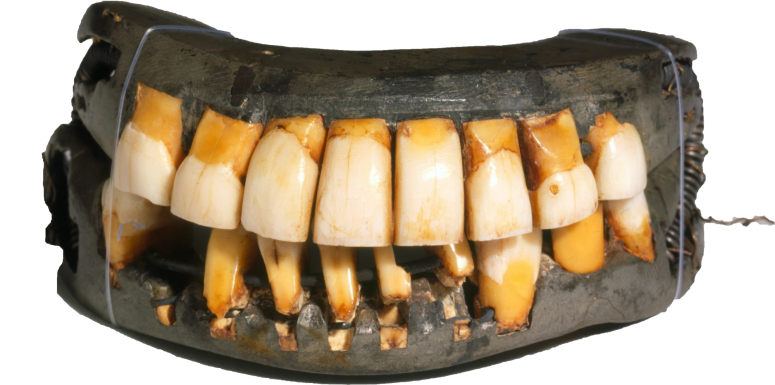 These dentures are in the collection at Mount Vernon – the only remaining full-set in existence.