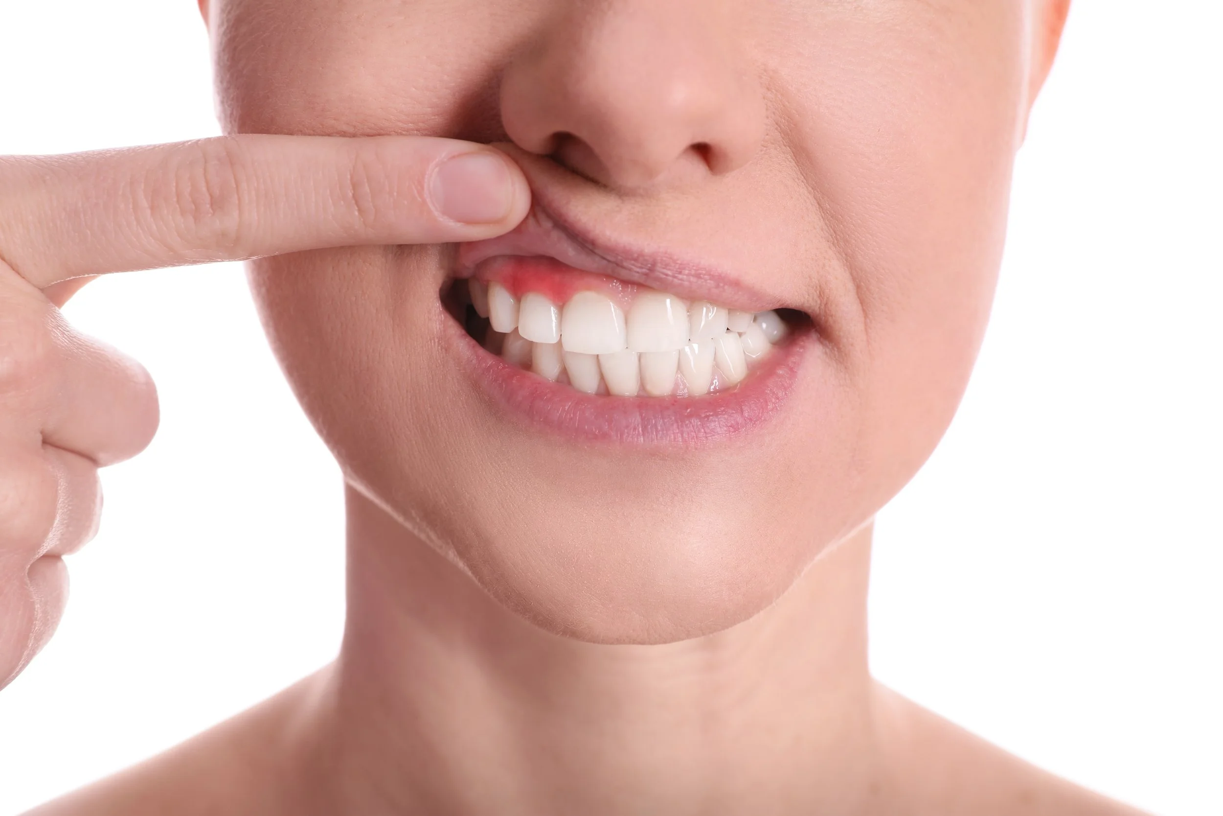 7 Everyday Habits That Can Protect Your Teeth and Gums