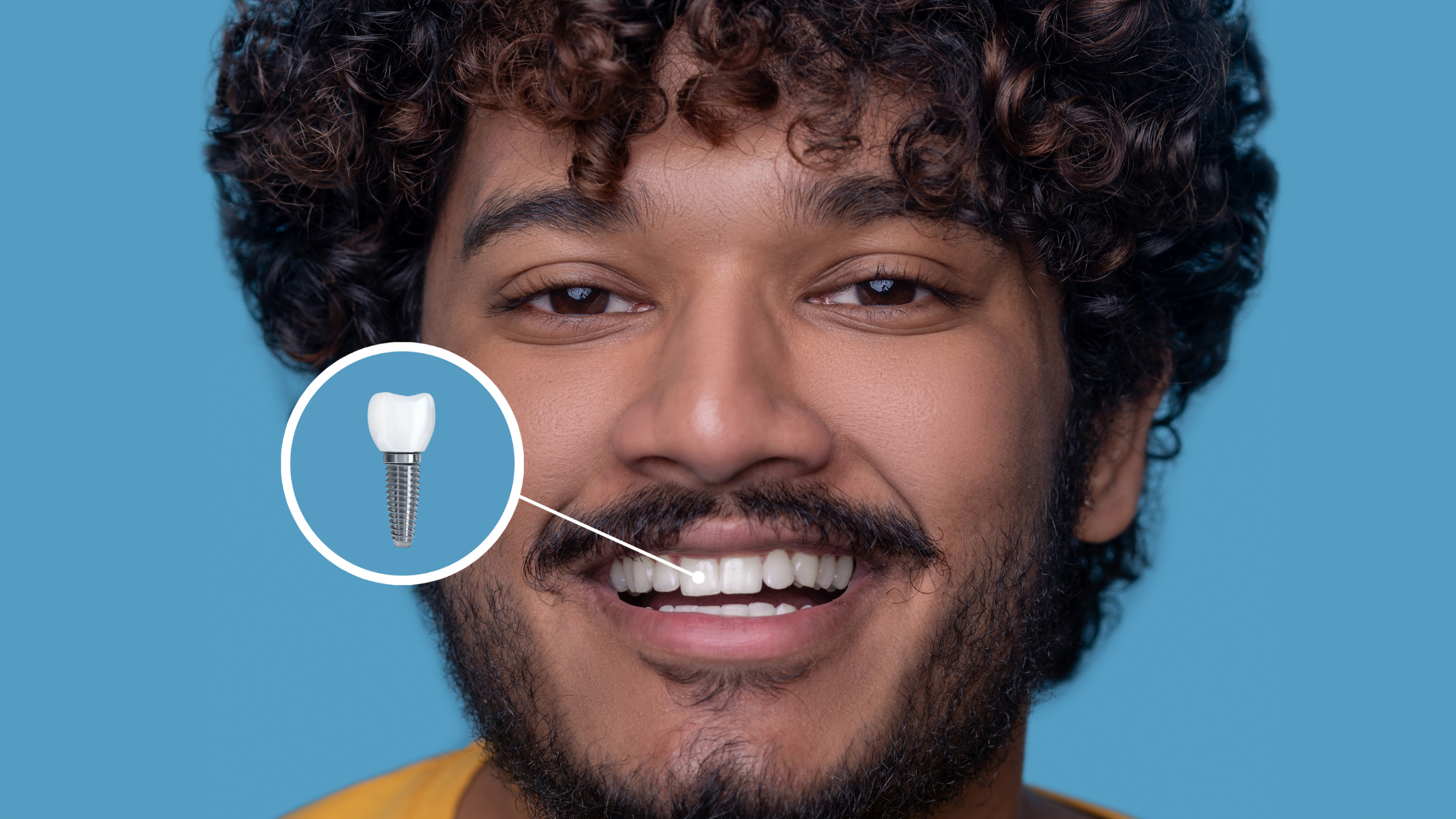 Get a Confident Smile Back with Full Mouth Dental Implants