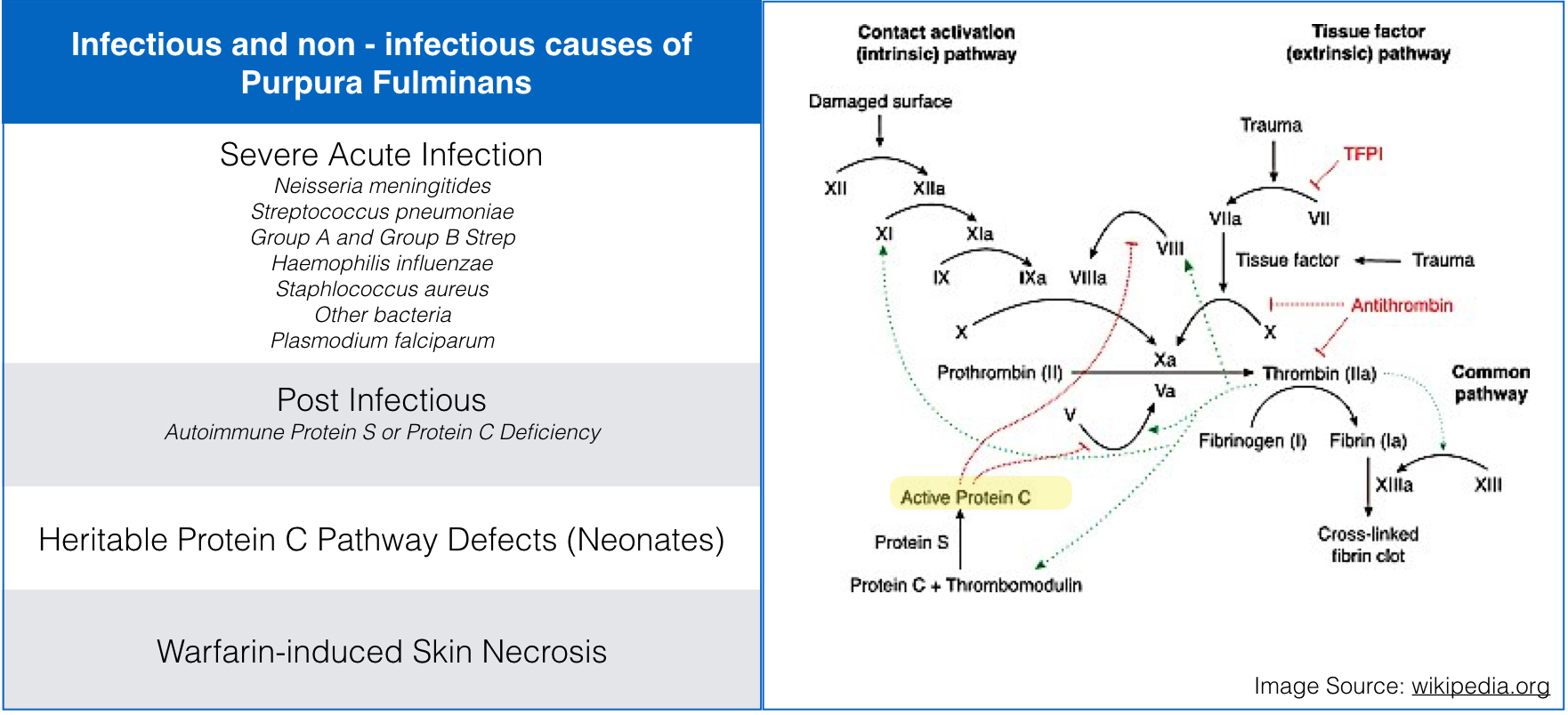 Protein C deficiency is the final common pathway of the multiple etiologies of Purpura Fulminans, including congenital, infectious, autoimmune, and drug-induced causes .