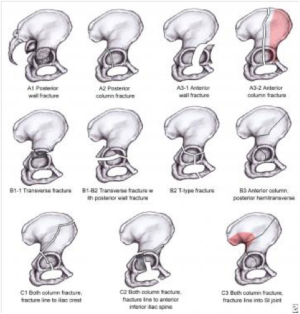 Image Source: emedicine.medscape.com