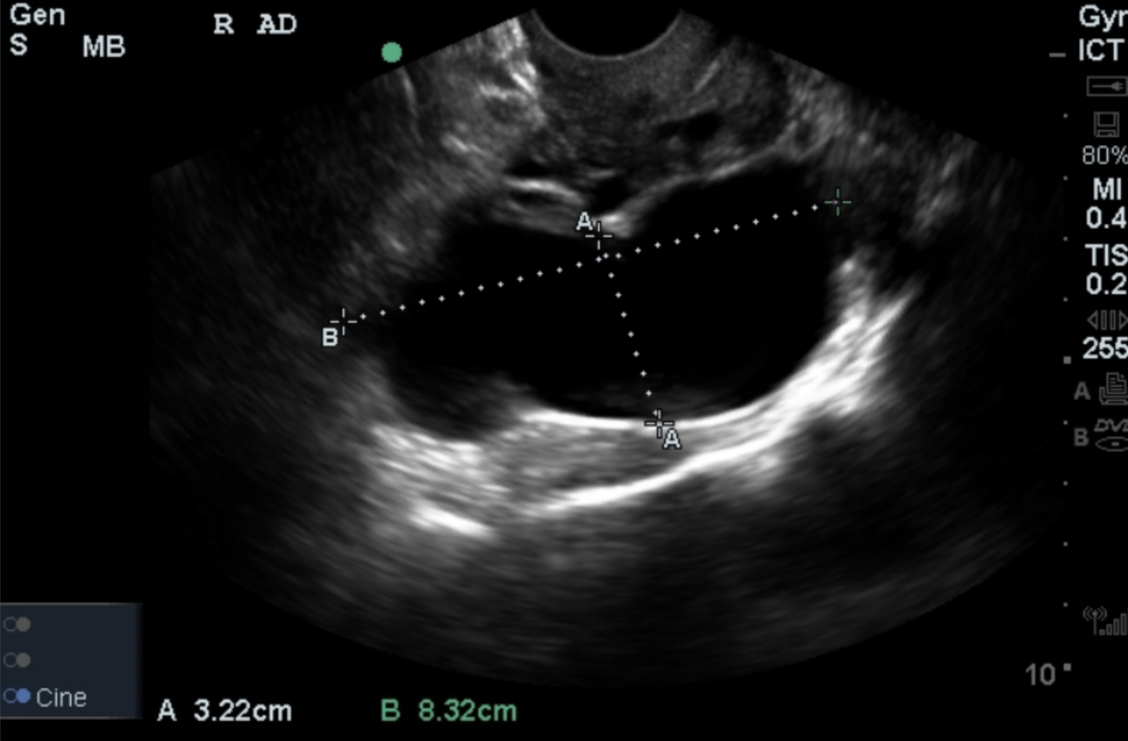 Ultrasound Case Series 1 Not Pregnant, but... — Everyday