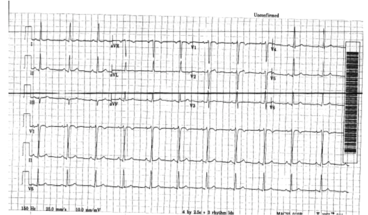ekg1.png
