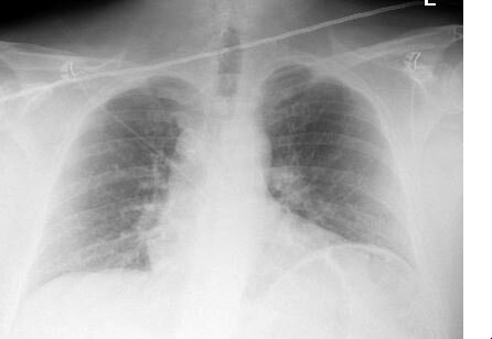 fathers xray