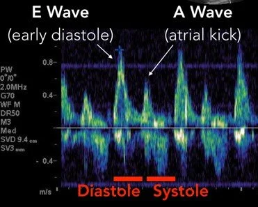 Post it Pearls — Everyday E(B)M