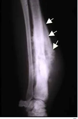 A 19 y.o. pitcher presents with a sore shoulder. He describes the pain ...