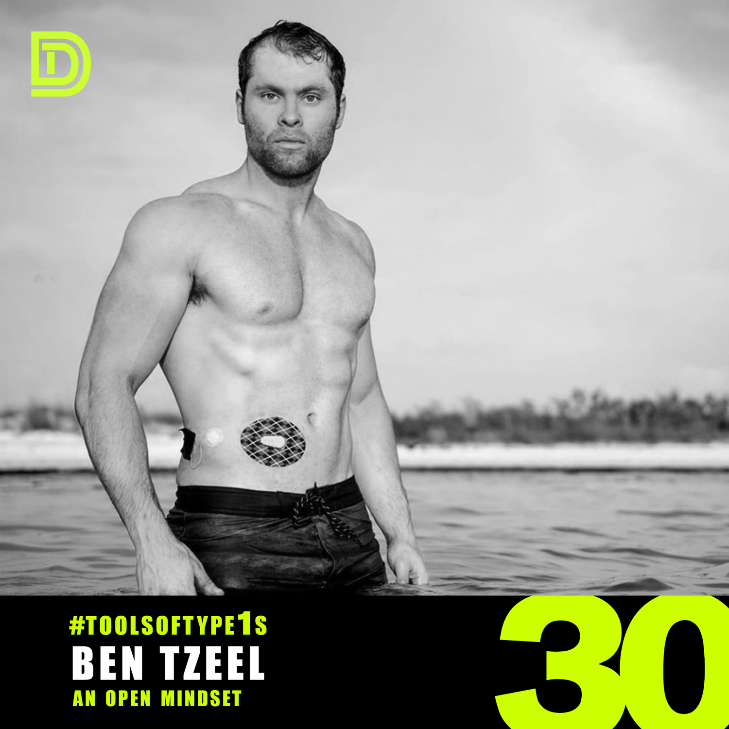 #ToolsofType1s - 030 - Ben Tzeel episode artwork