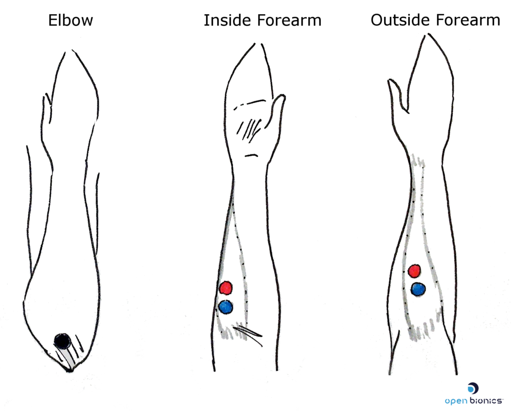 EMG sensor placement