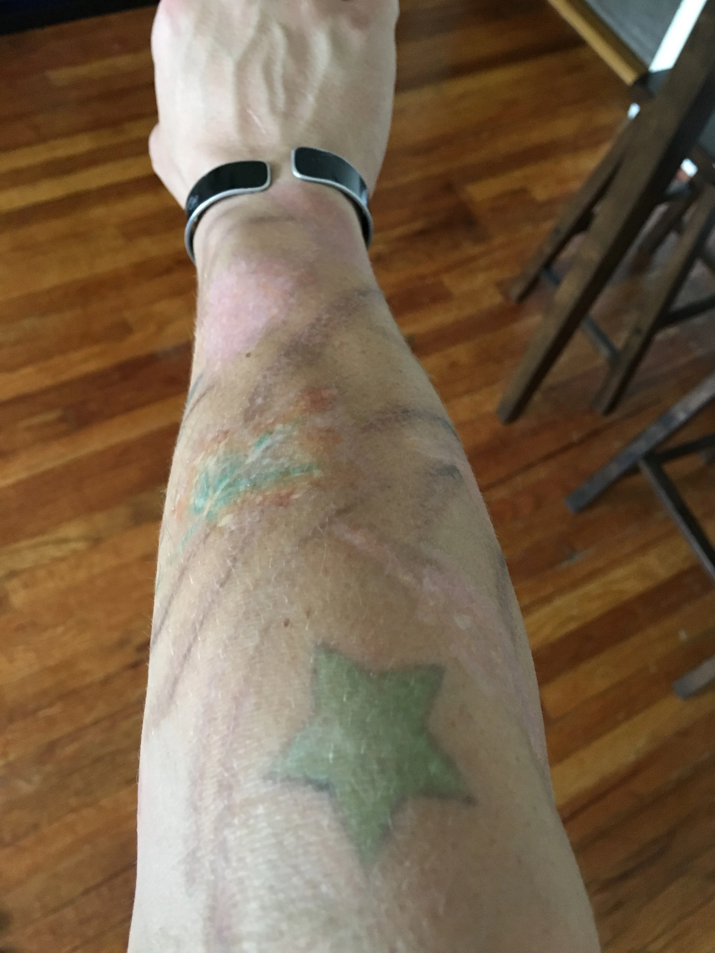 Josh's arm today.