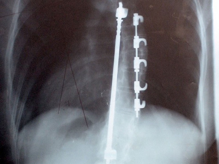 x-ray-website.jpg