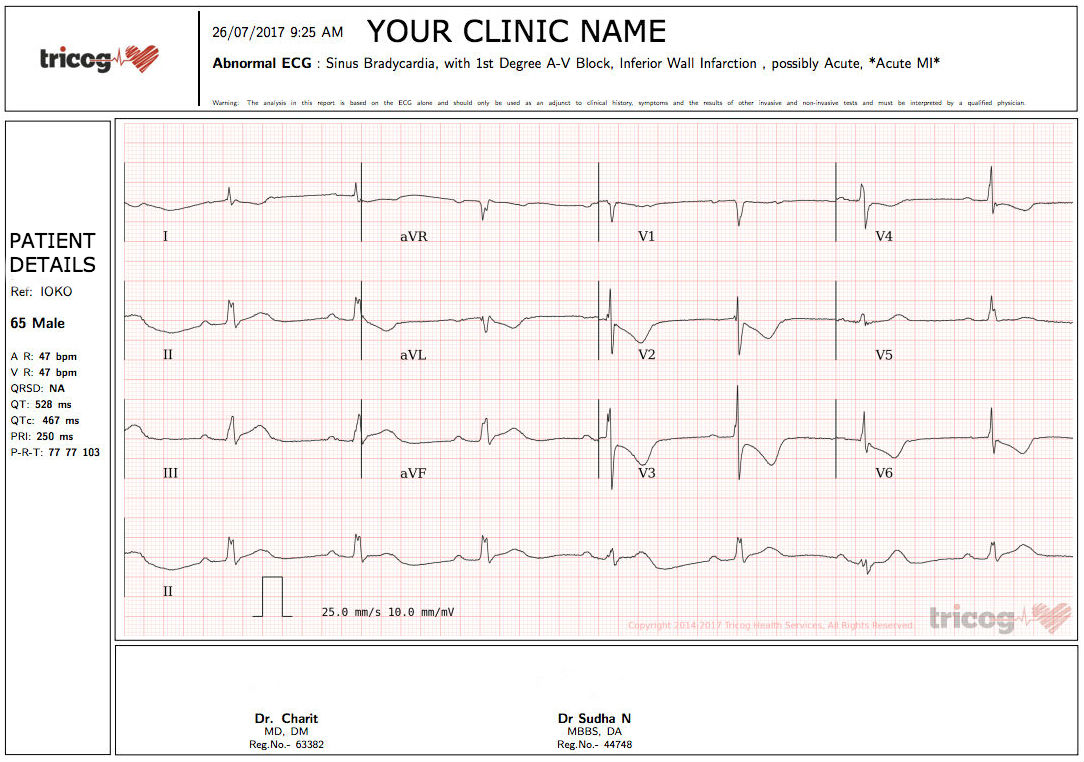Sample_ECG.jpg