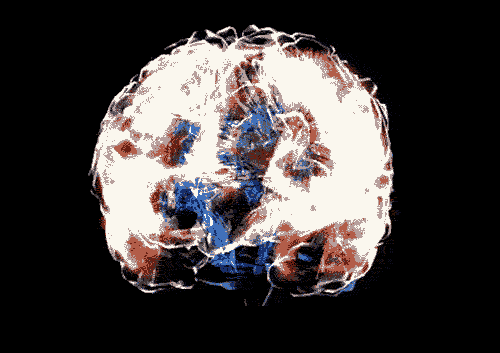 Brain.gif