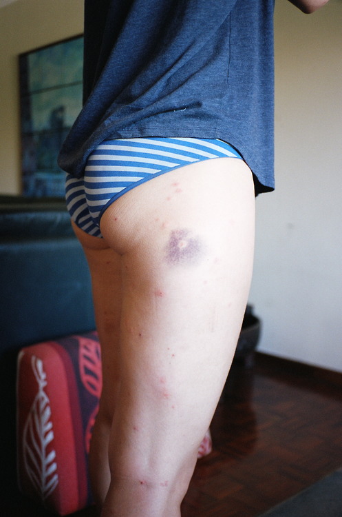 Battle Scars, 2012.jpg