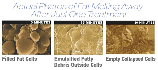 fat.jpg