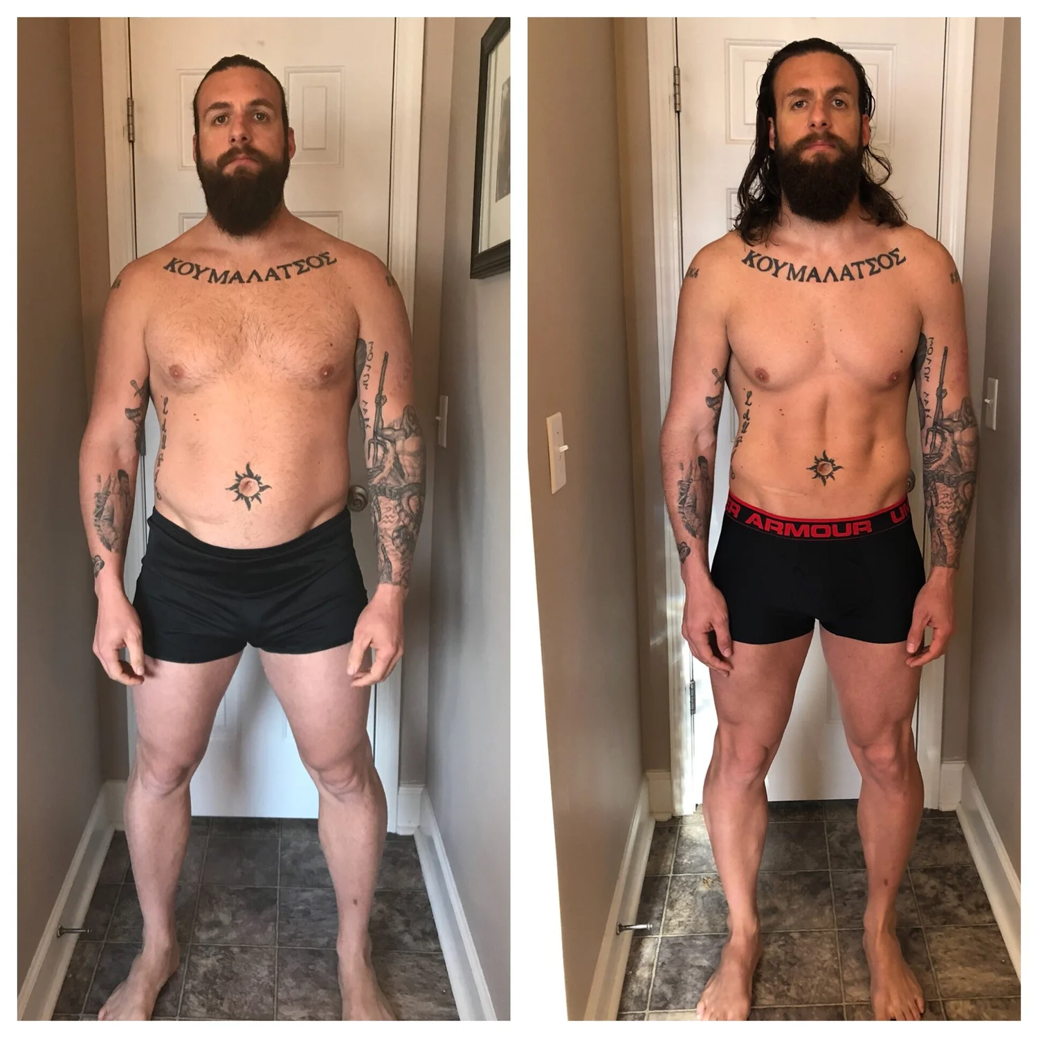 腎臓の嚢胞が問題を引き起こす可能性があります