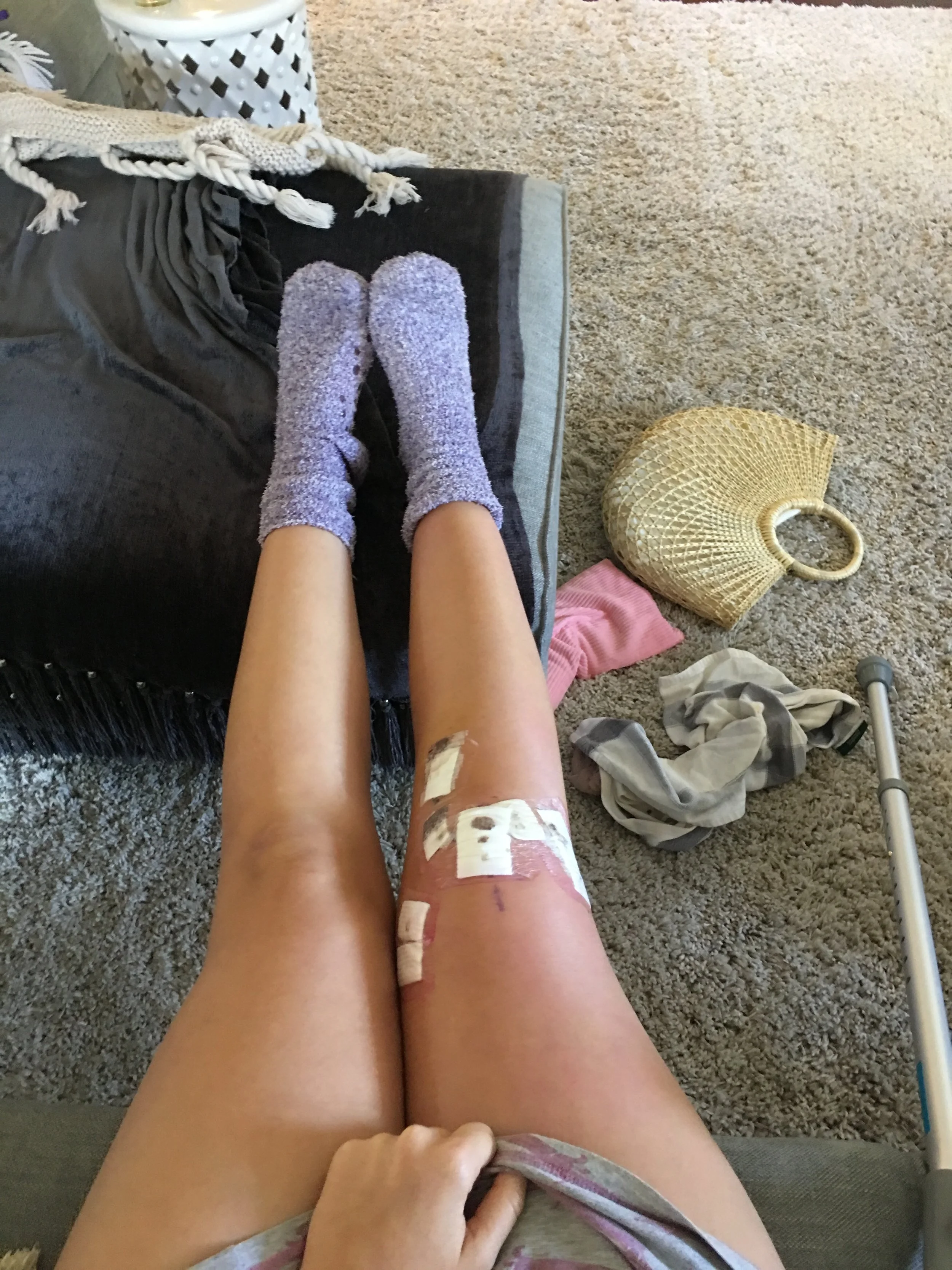 How to prepare for knee surgery.