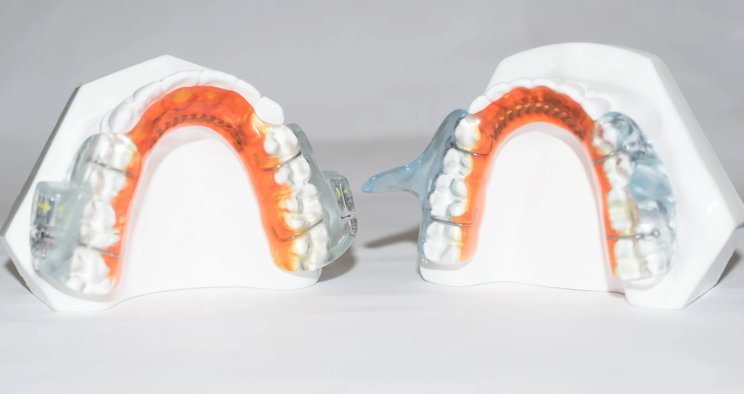 Picture 2: Oravan is composed of two separate pieces. The bottom component has a dorsal fin on each side. The fins engage with the titration mechanisms, which are located on each side of the top piece. Please note the orange shading is for illustration purposes only. All devices are made in clear acrylic. 