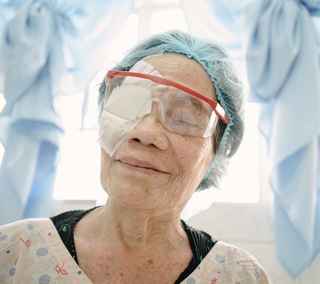 Emma Buñi, just after her eye surgery. Emma lived with blindness due to cataracts before undergoing surgery in the Philippines. Globally the number of people who are visually impaired is 285 million, of whom 39 million are blind; majority of those w