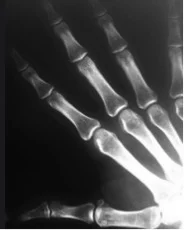 xray.jpg