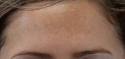 Perf 10 intermediate peel before.JPG