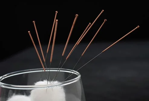 getty_rm_photo_of_acupuncture_needles_and_cotton_swab.jpg