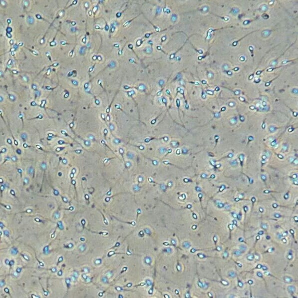 Sperm