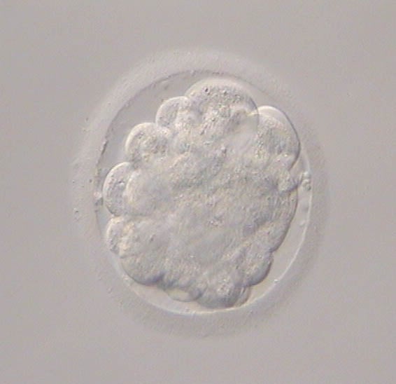 Day +4 of fertilisation (morula stage)