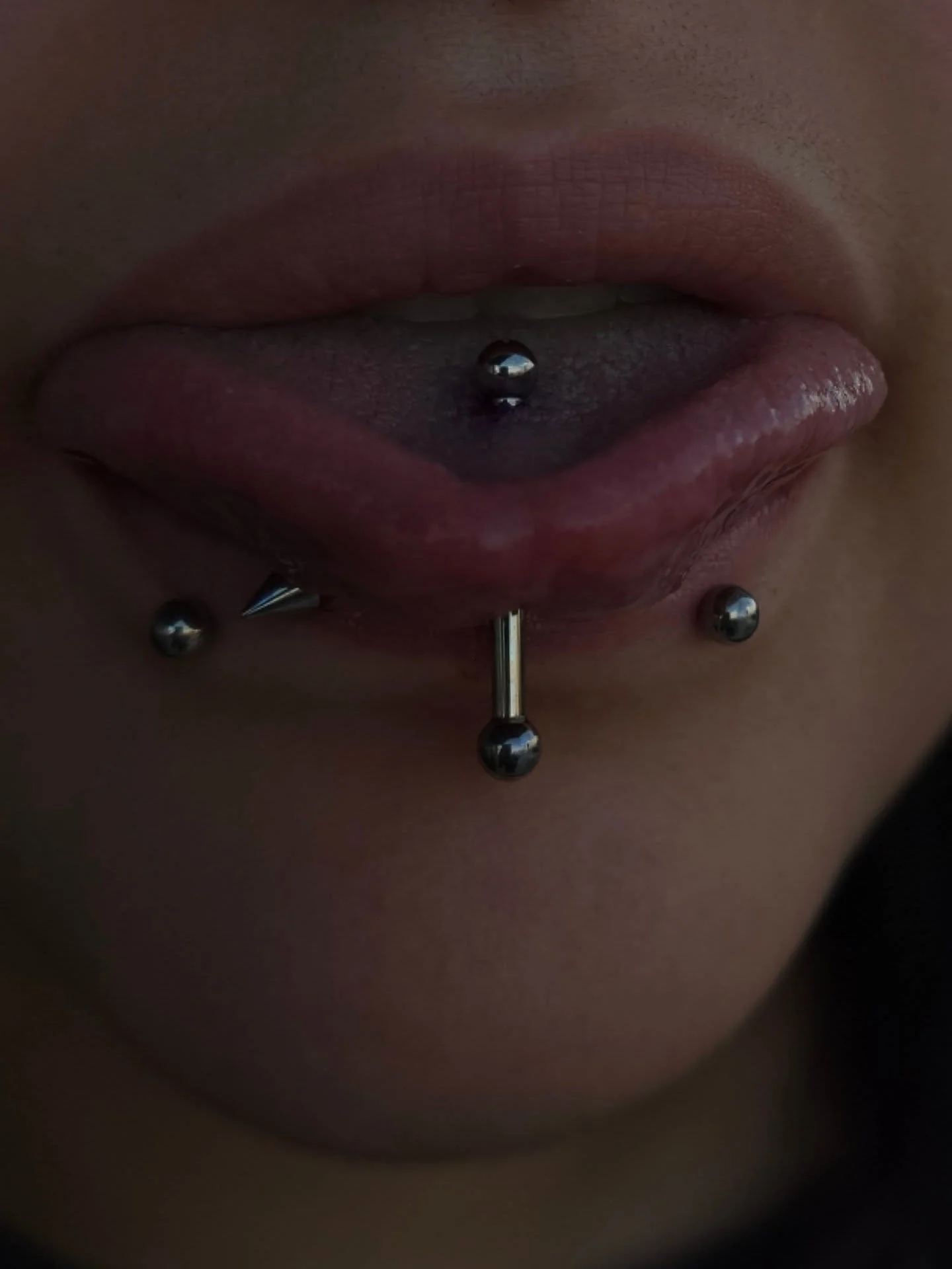 Eeevery once in a while a tongue rolls through and I ain't mad about it at all. 👅
Getting this is easy AF.
Healing it is annoying, but if you can get past ✌🏼 weeks, you're golden. Can't wait to downsize this and get her something that fits perfect