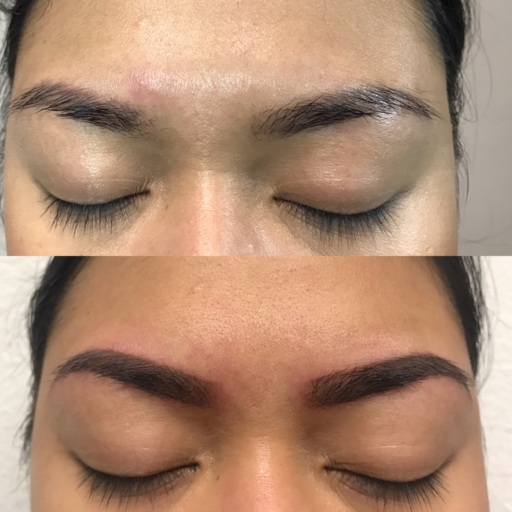 F R O N T V I E W - left brow missing in the front