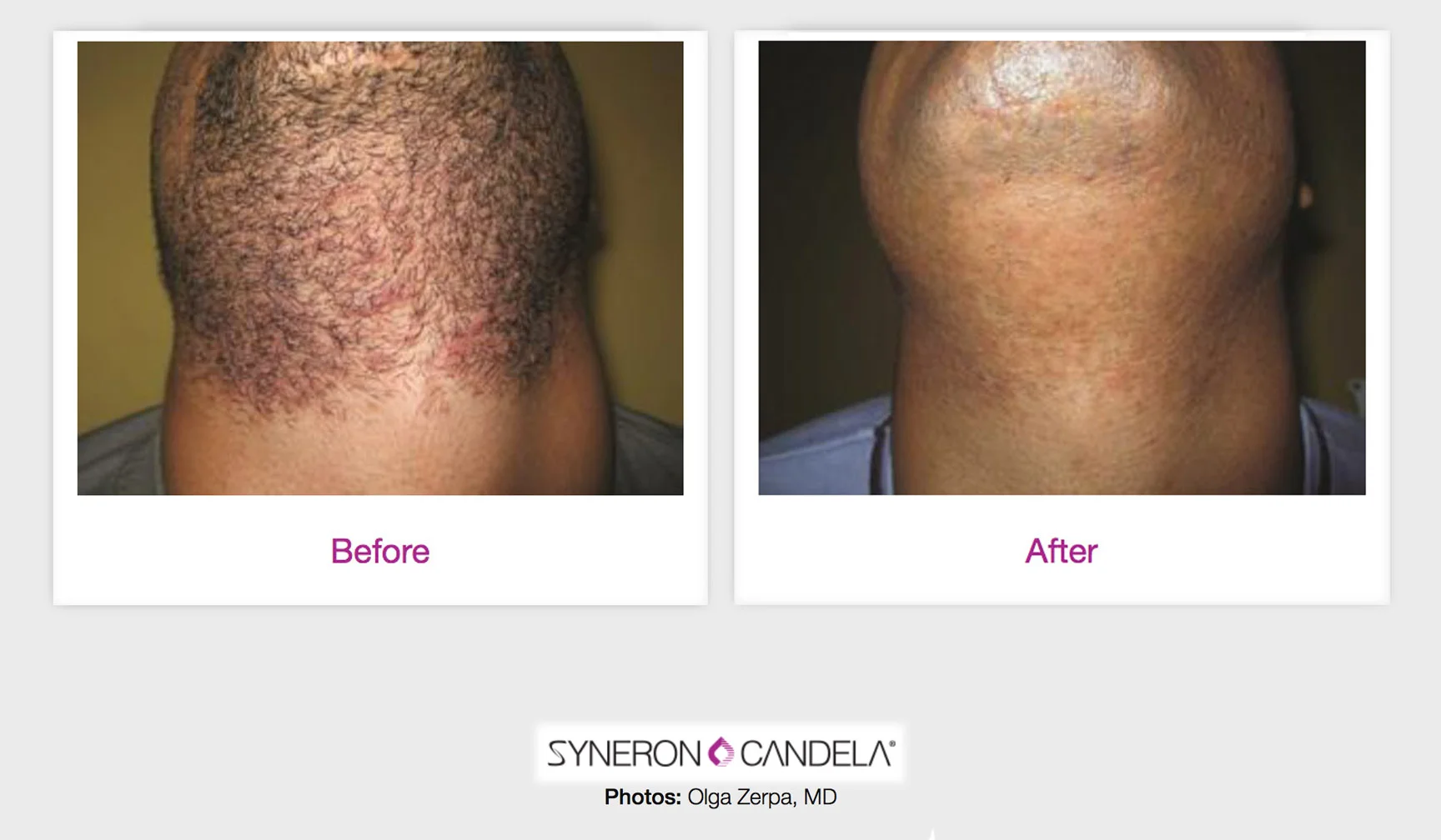 Beforeafter2.jpg