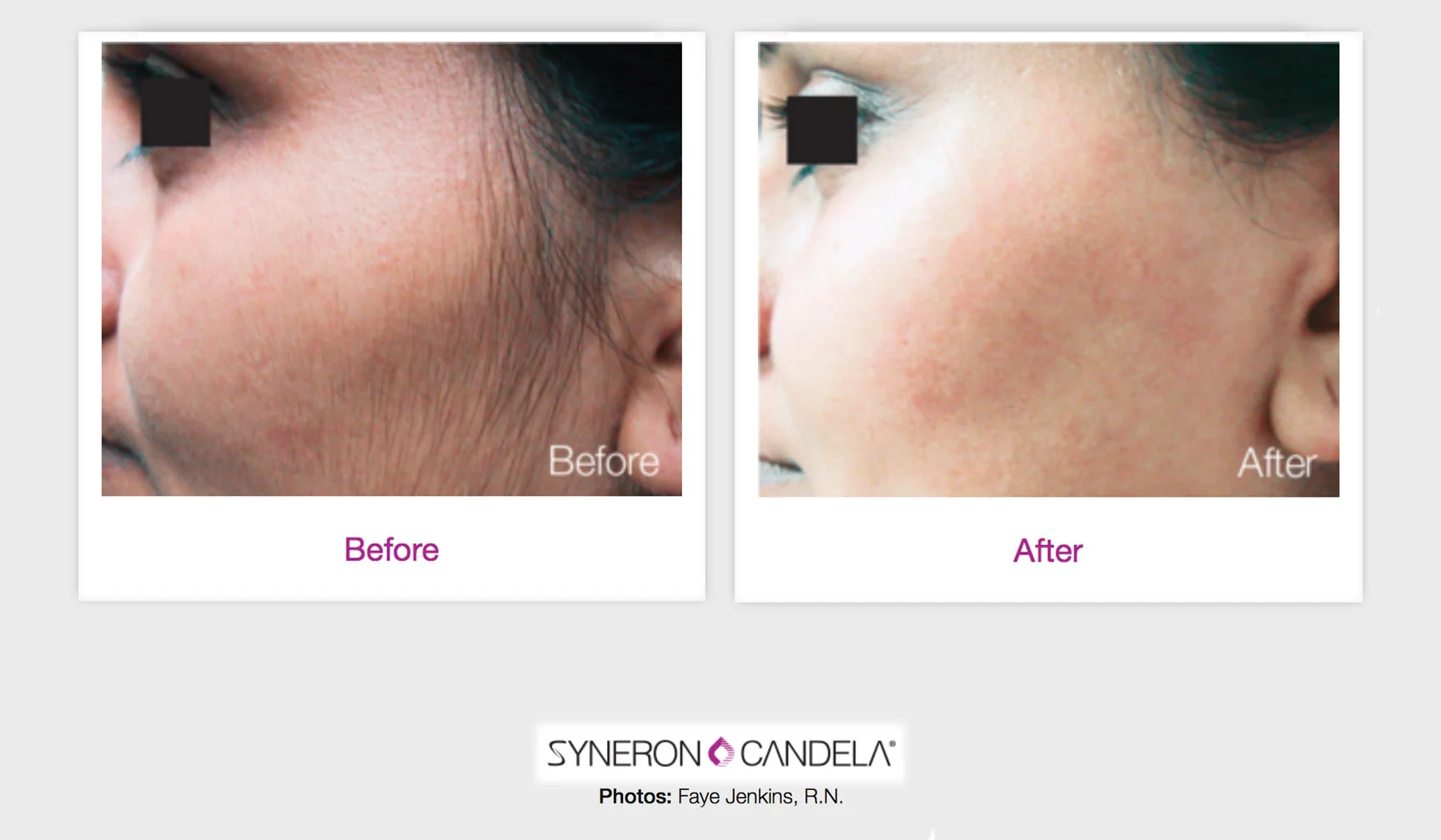 Beforeafter1.jpg