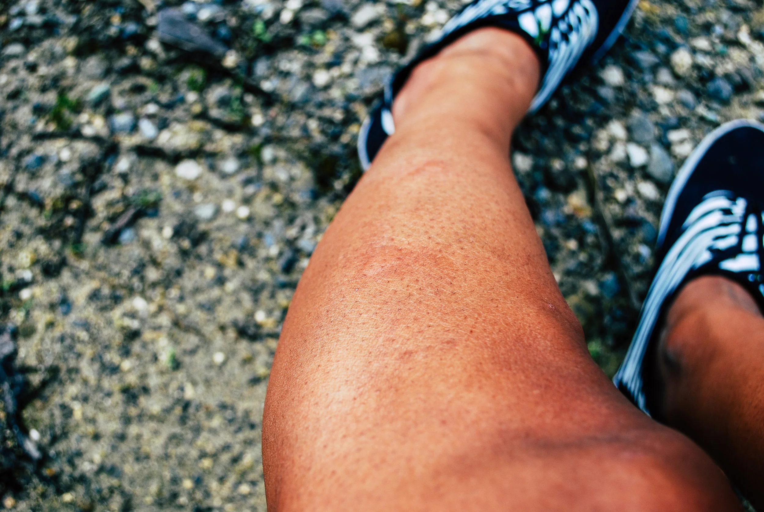 Close-up of tanned legs and feet wearing black and white striped sneakers, sitting on rocky ground with small stones and patches of moss.