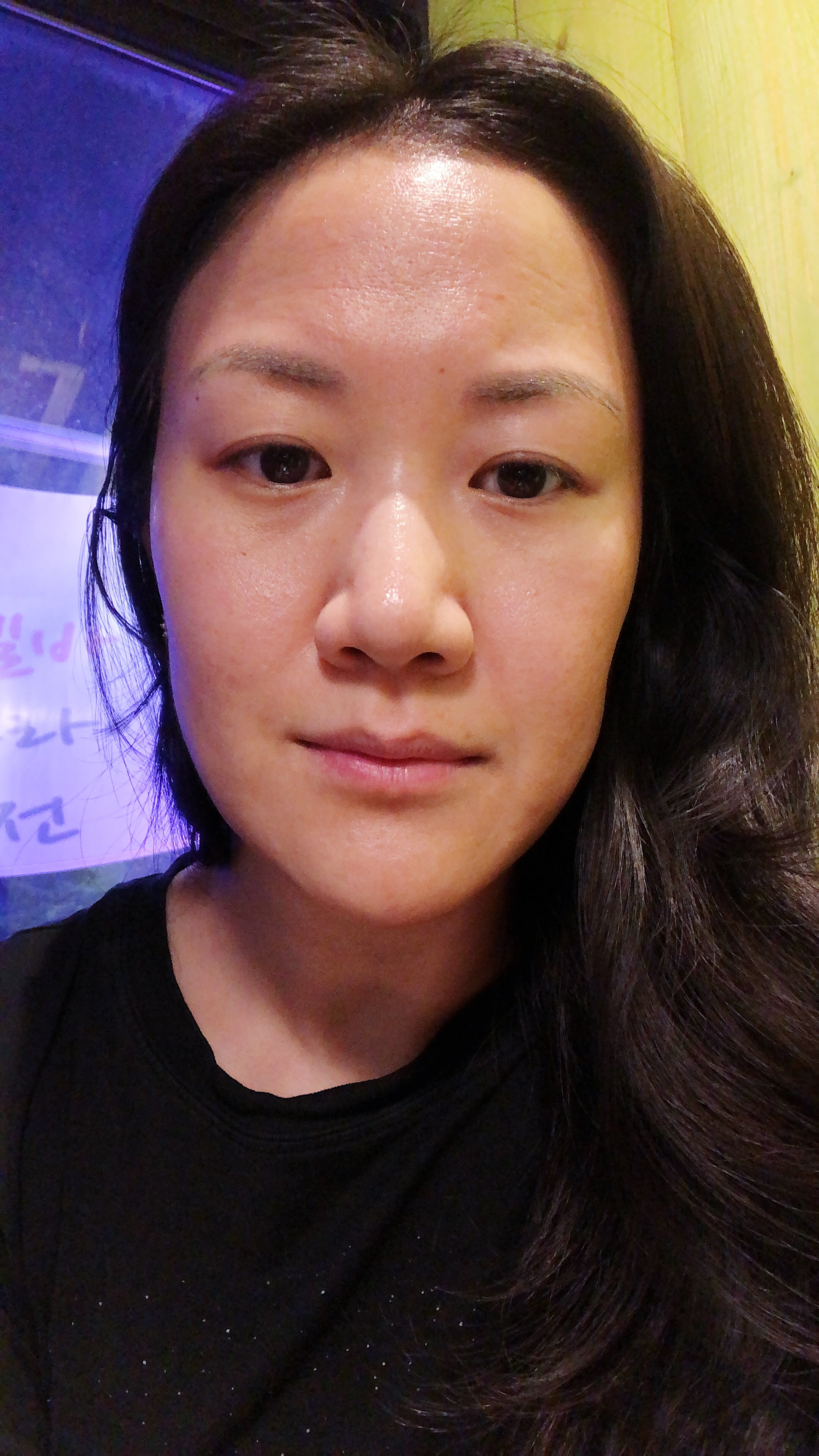Seoul Skincare Journey: Part 3, The Peel